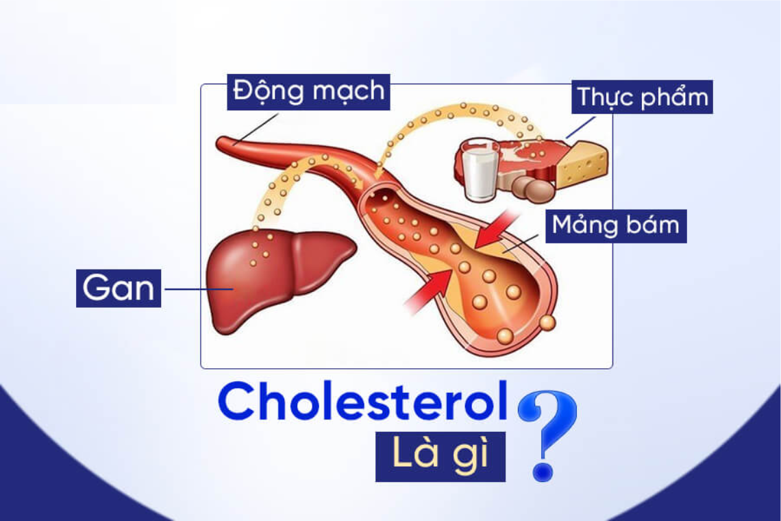 cholesterol công thức